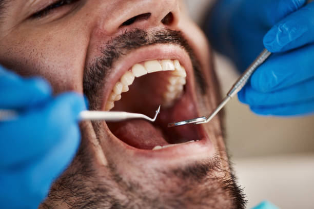 Best Same-Day Emergency Dentist in Blue Mound, TX